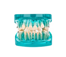 Модели зубов