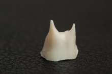 Изготовление культевой вкладки из оксида циркония ZrO2 (IPS e.max ZirCAD)