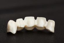 Изготовление каркаса из оксида циркония (IPS e.max ZirCAD)