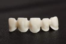 Изготовление каркаса из оксида циркония (IPS e.max ZirCAD)