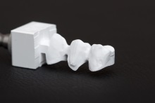 Изготовление каркаса из оксида циркония (IPS e.max ZirCAD)