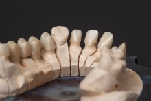 Изготовление каркаса из оксида циркония (IPS e.max ZirCAD)