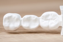 Изготовление каркаса из оксида циркония (IPS e.max ZirCAD)