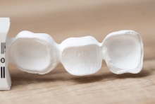 Изготовление каркаса из оксида циркония (IPS e.max ZirCAD)