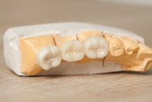 Изготовление каркаса из оксида циркония (IPS e.max ZirCAD)