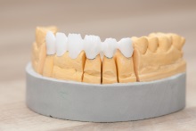 Изготовление каркаса мостовидного протеза из оксида циркония (IPS e.max ZirCAD)