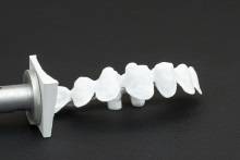 Изготовление каркаса мостовидного протеза из оксида циркония (IPS e.max ZirCAD)