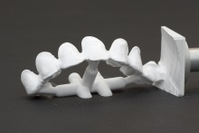 Изготовление каркаса мостовидного протеза из оксида циркония (IPS e.max ZirCAD)