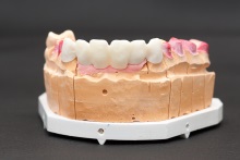 Изготовление каркаса мостовидного протеза из оксида циркония (IPS e.max ZirCAD)