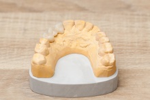 Изготовление коронок, вкладок и виниров из литий дисиликата (IPS e.max CAD)