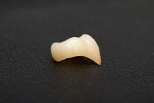 Изготовление коронок, вкладок и виниров из литий дисиликата (IPS e.max CAD)