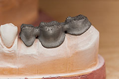 Селективное лазерное плавление laserCUSING