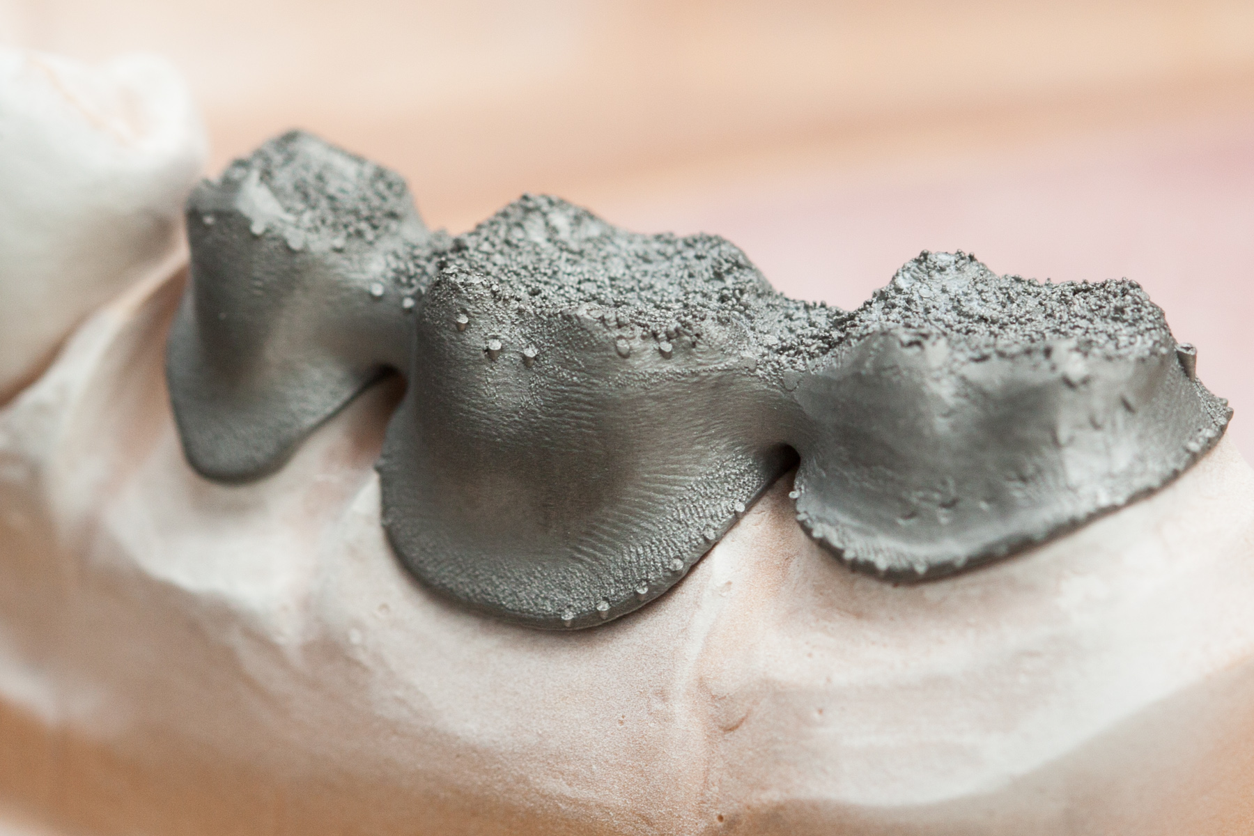 Каркас, изготовленный из CoCr с помощью технологии laserCUSING